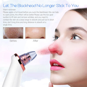 Electric Blackhead Remover