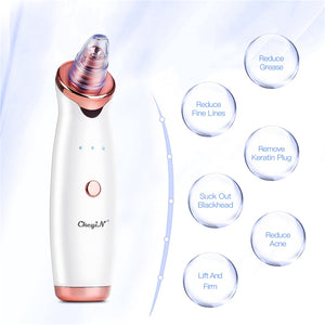 Electric Blackhead Remover